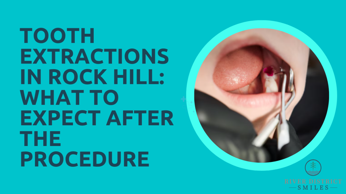 Featured image for Auto-prepared featured image